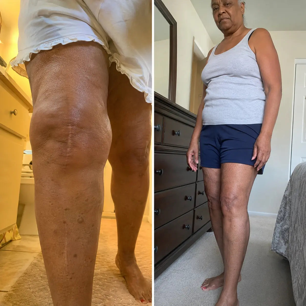 Customer swelling progress before and after